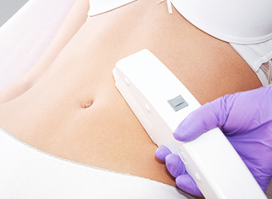 IPL Hair Removal Technology